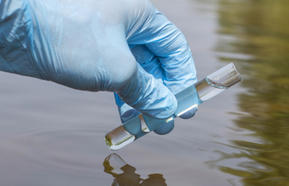 Sample water from the river for analysis. Hand in glove holding.